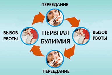 Лечение булимии в Георгиевске